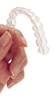 Invisalign® Raleigh, NC  Invisible Clear Aligners